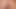 Anal sert