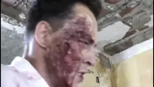 Mutlak lateks !!! - travma #02