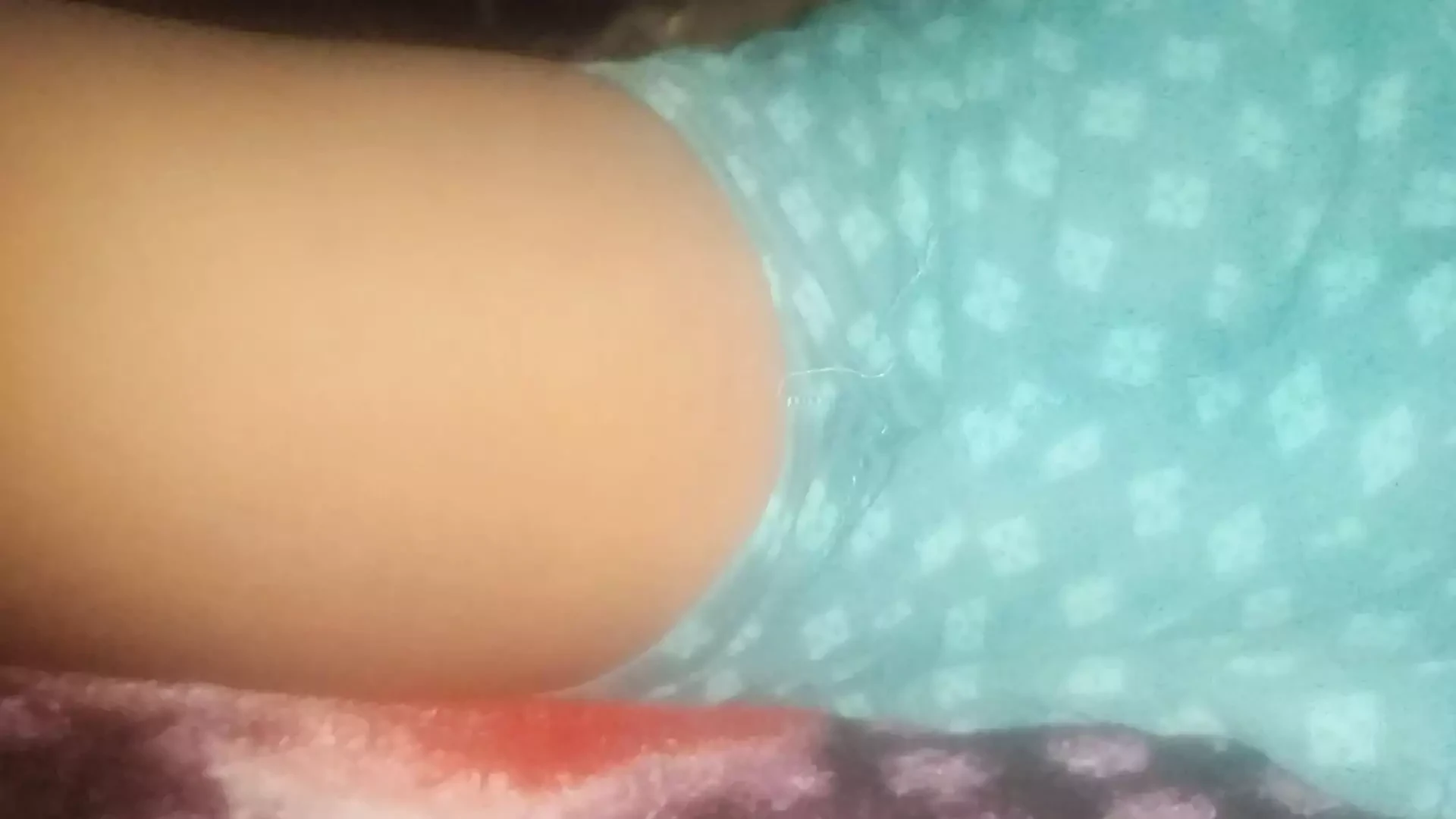Armpits