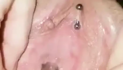 Üretral sondaj çift penetrasyon