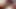 Diş teli takan genç jakuzide parmaklanıyor – sexfreunde.com