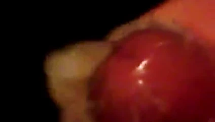 prezervatif doldurmak