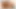 Ballbusting ve süspansiyon