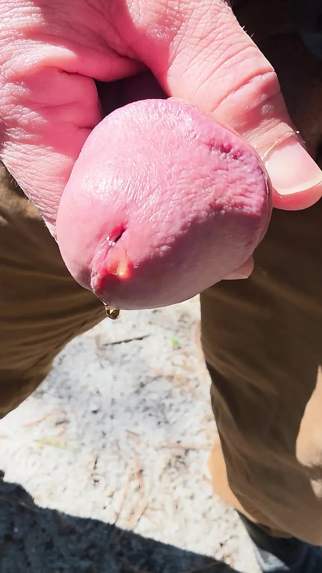 Güneşli gün sidik videosu
