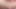 Extreme anal transvestite (psykoanal)