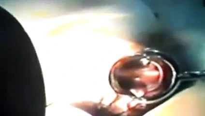 Zhangjiajing hemşireler hizmetçi Tayvanlı Tayvan hemşireler13