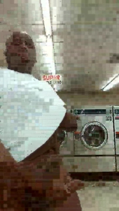 üzerimdeki röntgenci