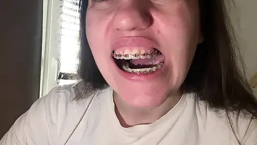 Dilinizle diş teli yalamak