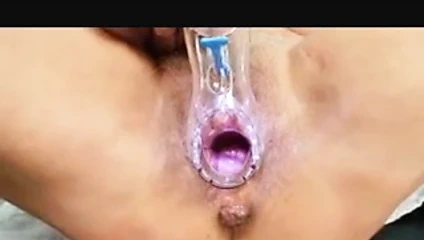 nine jinekolog sınav