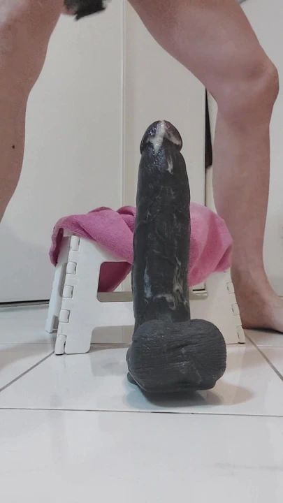 "Aşırı anal dilasyon, 14 cm çapında" dan epik an