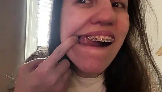 Dilinizle diş teli yalamak