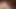 Mandingo anal sarışın hemşire