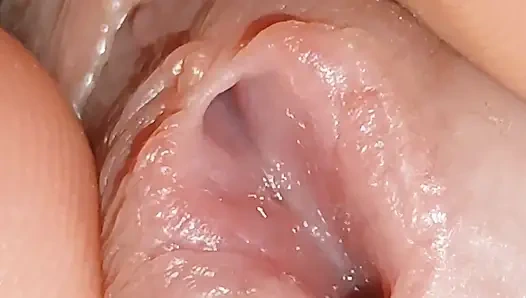 Derin Üretral Deliğin Büyümesi!!