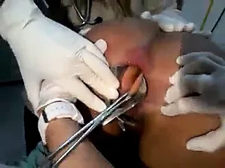 Anal yanlış gittiğinde