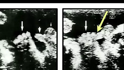 Seks hakkında konuşalım. orgazm.