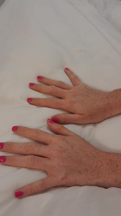 Tırnaklarımı yaptırdım, sence etine sarılmış güzel görünecekler mi x