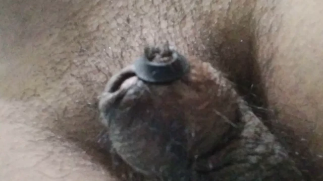 eller serbest açılış sünnet derisi