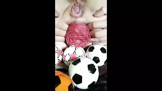 Anal prolapsus sefahat