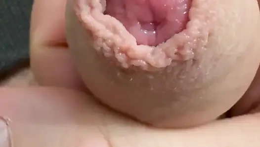 Sünnet derisi. Bir yarağın başını gösteriyor.