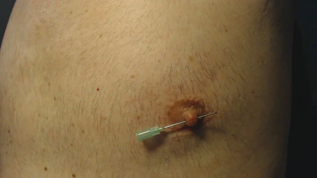 Боль от сосков и игл