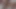 Lizzy Yum VR MAY 2023 JUST ME #10 post op orgasm pussy anal masturbation teasing orgasm and bathing