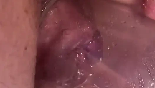 Aşırı anal vakum pompası eğitimi 2025