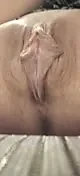 Gıdıklıyor ve çok telaş verici