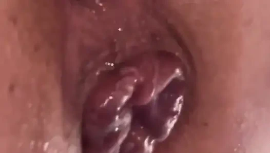 Aşırı anal vakum pompası eğitimi 2025