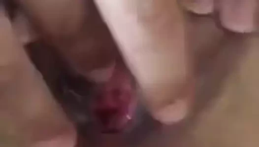 anal