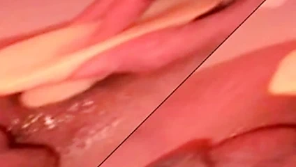 Götüme büyük tıkaç 2