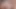 viral