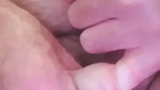 Parmak deliğe sıkışmış