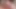 A mentally ill woman comes vaginally all the time. She is masturbating every day with all the physical strength