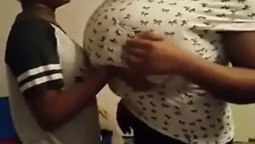 Dev çirkin macromastia büyük memeler