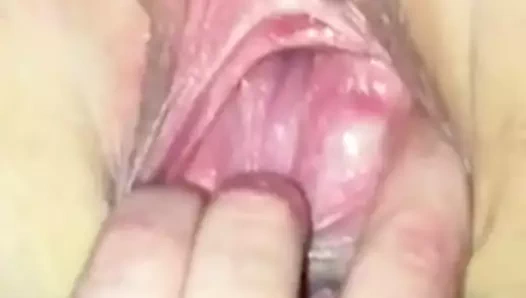 gape