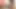 Hata yapma, Emma Ray oynamaya geldi