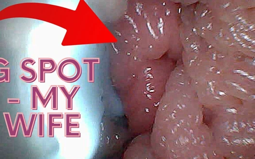 G Noktası Stimülasyonu ve Orgazm için Görsel Kılavuz - Endoskopik Perspektif