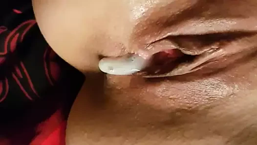 Mel'in yerinde sihir, cilt 4 spekulum muayenesi, lateks eldivenler.