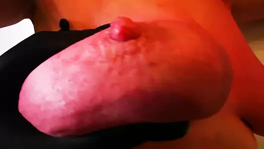 Büyük ve şişmiş olana kadar aşırı ağrılı meme dayağı