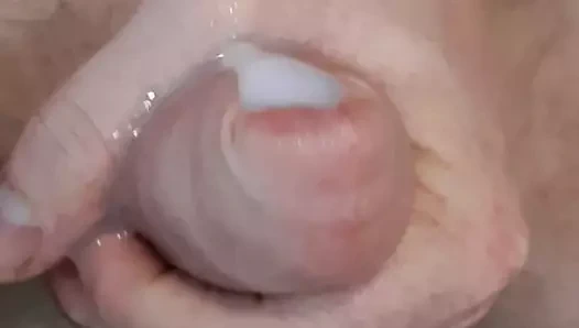 sünnet derisine cumming