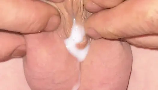 Mikro yarak hazırda bekleme modunda