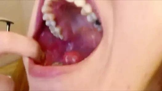 Gülümsemeler, dişler ve derin boğaz