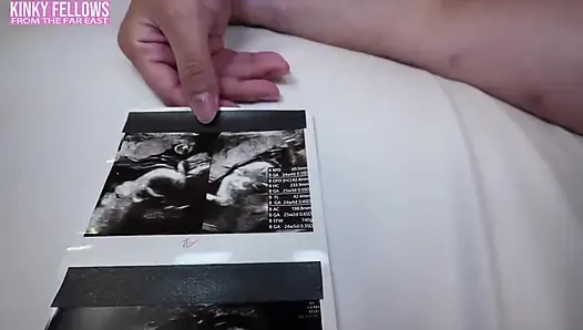 Arzu hala 26 haftalık hamileyken yanabilir mi? J cup gravure idol riskli mini üniforma fantezisi yapmaya cesaret ediyor