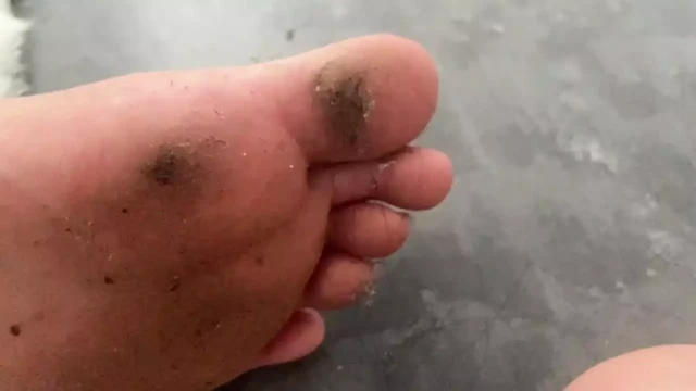 Eşcinsel ayak fetişi