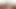 Madison genç teaser 21