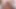 Fortnite video komplikasyonu