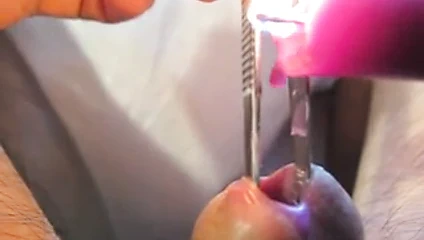 Sıcak mor balmumu içinde üretra