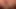Hastalara anal seks yapmasına izin veren bir Fransız hemşire