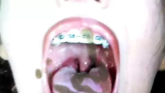 Rastgele boşalma hedefi 19 - boşalma haraç (açık ağız diş teli sürtüğü)