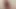 Sünnete aşırı hava şişirmek porno